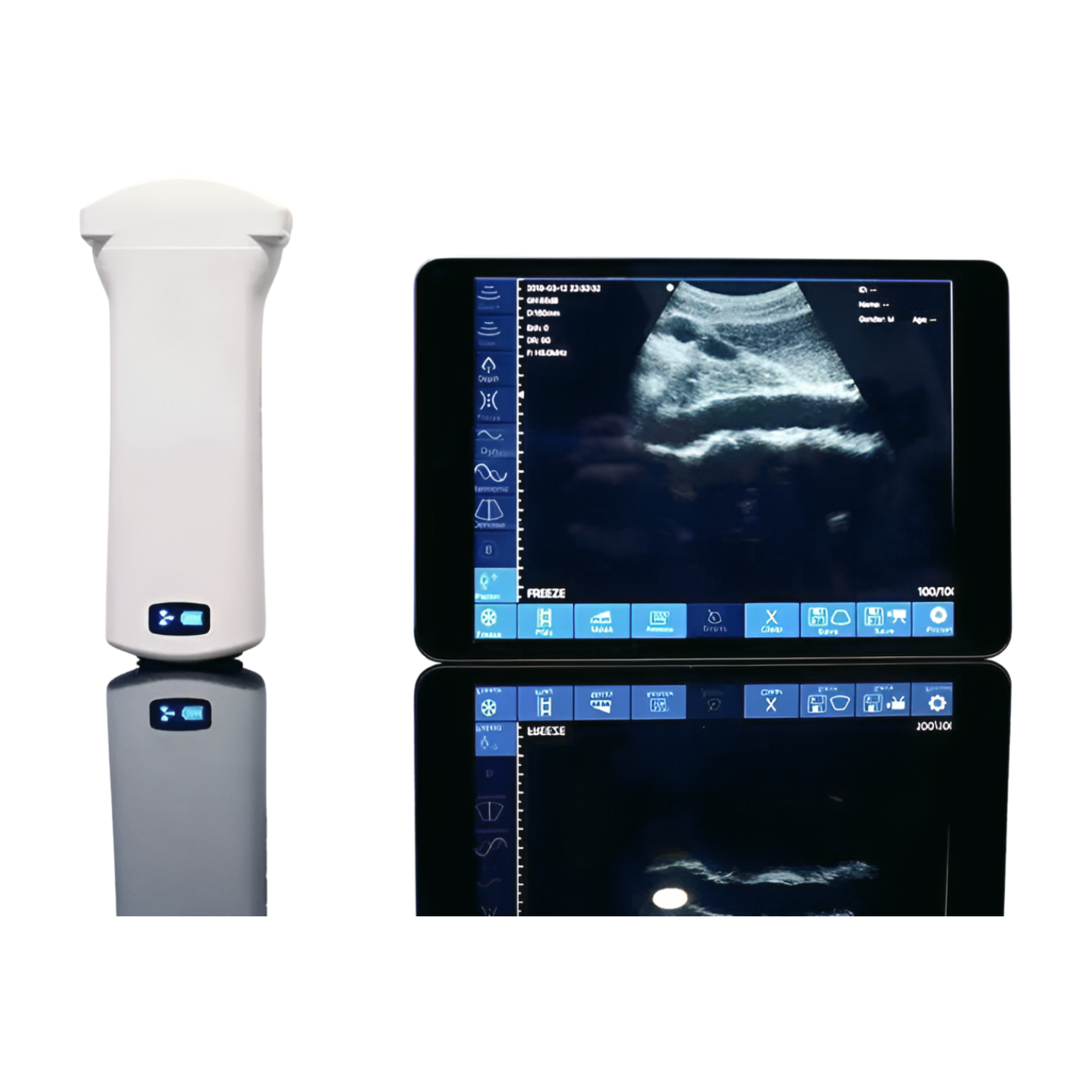 SonoStar 6C