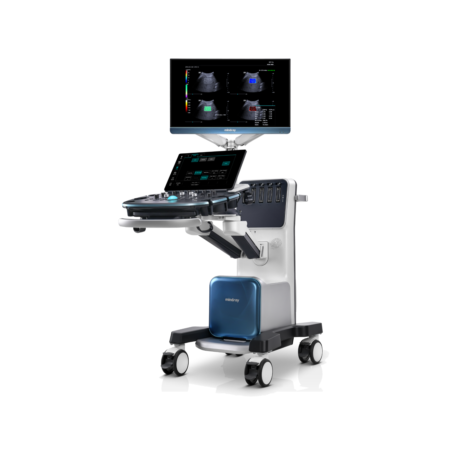 Mindray Resona I10