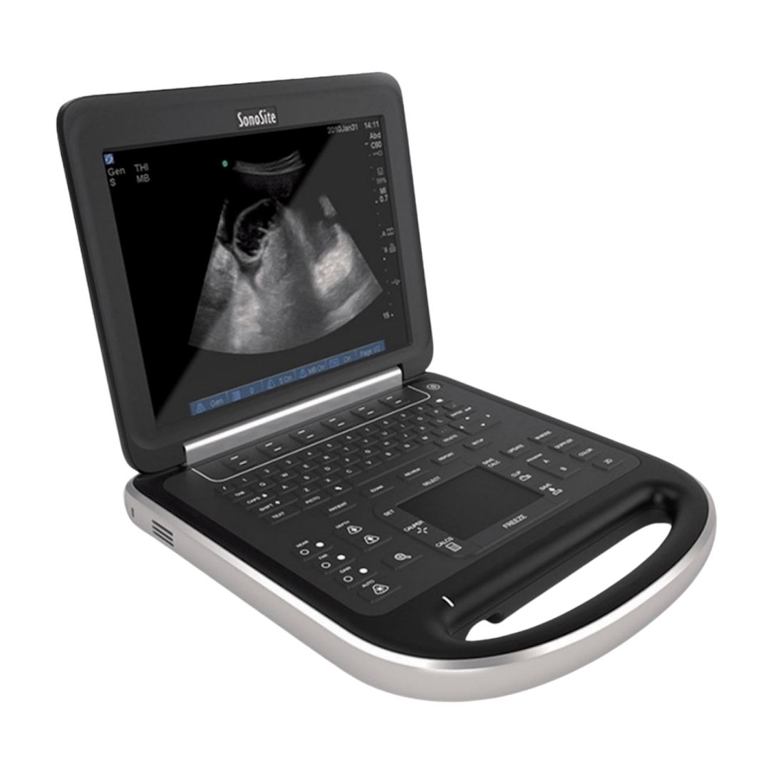Sonosite Edge