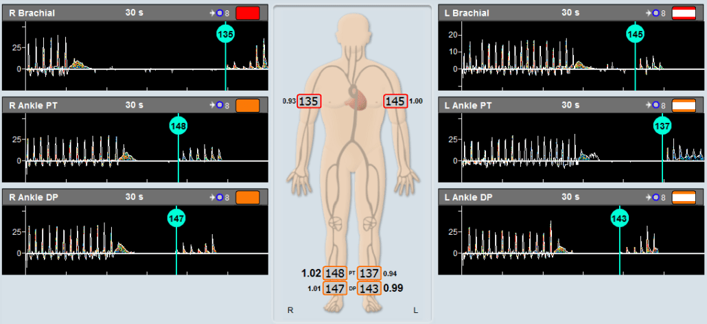 Fast and Accurate ABI & TBI