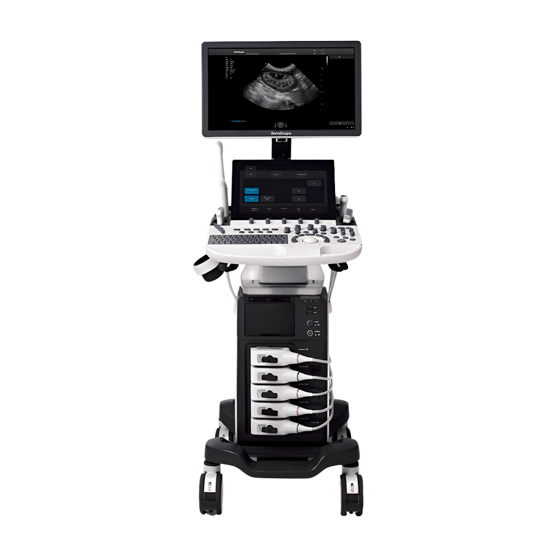 Sonoscape P40 Elite