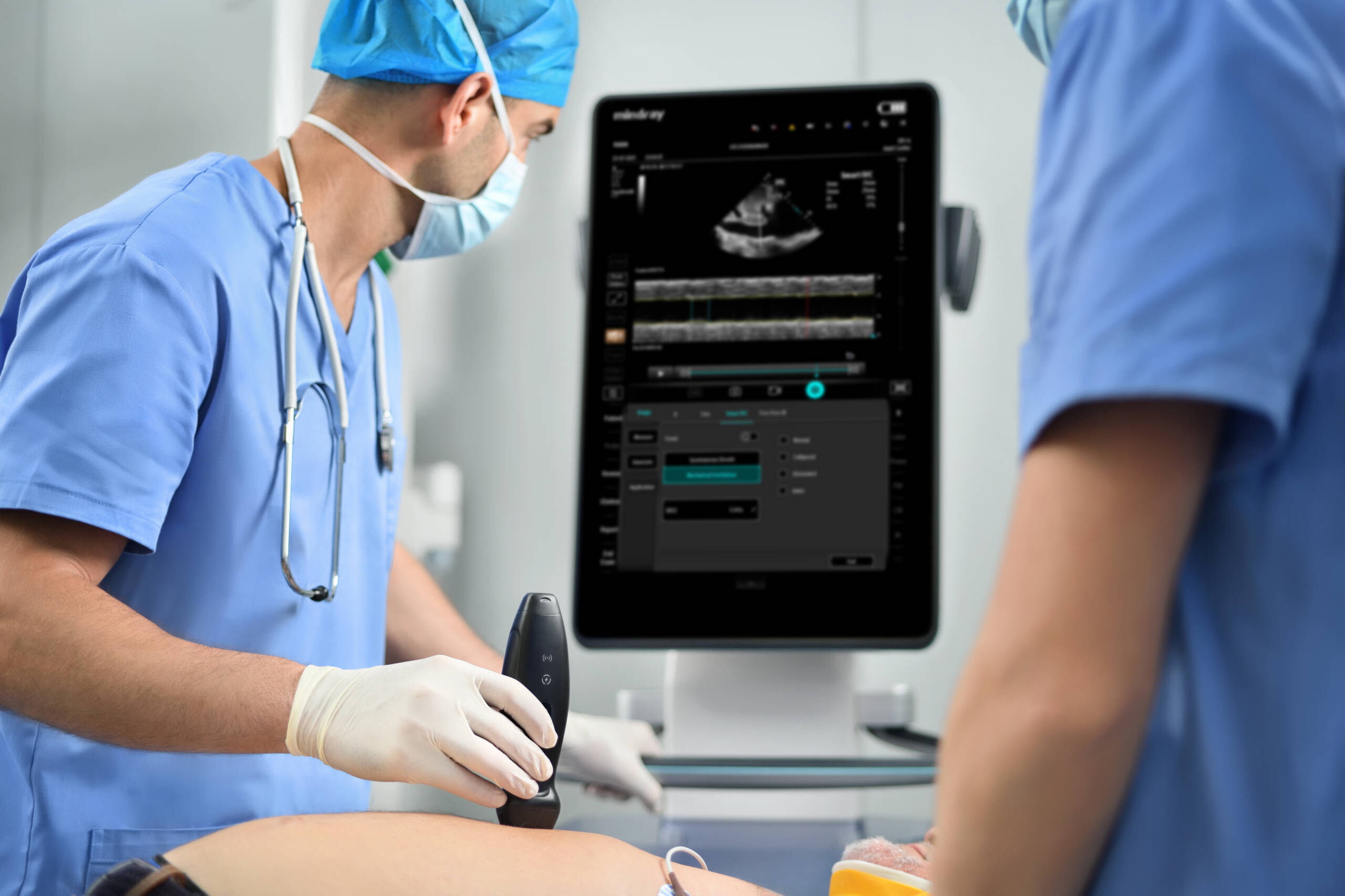 ultrazvučni uređaj ultrazvuk ultrazvučni aparat mindray TEX20 TEH KARAKTERISTIKE prodaja zagreb hrvatska Mindray bežična sonda TE AIR i TEX20