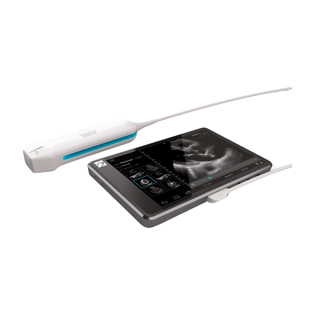 Sonosite iViz
