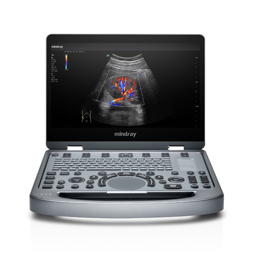Mindray MX3
