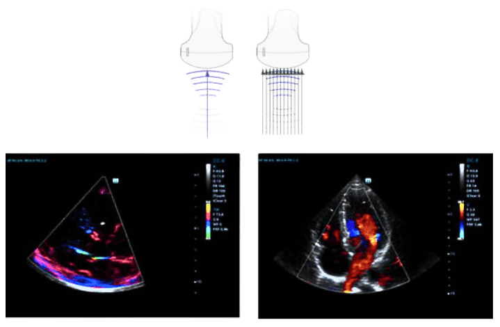 Prijenosni ultrazvuk Mindray M9 kliničke slike