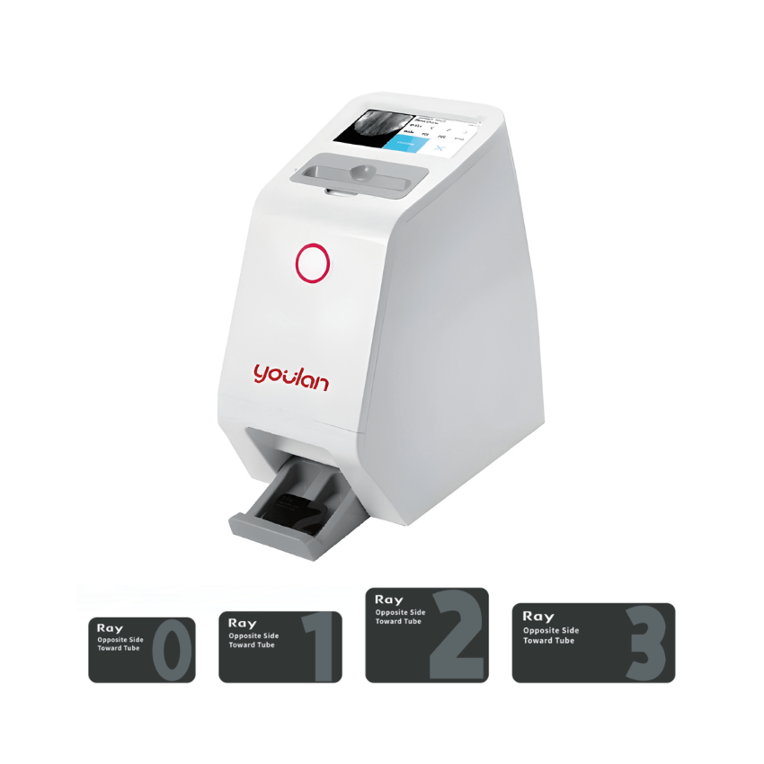 Youlan digital intraoral sensors