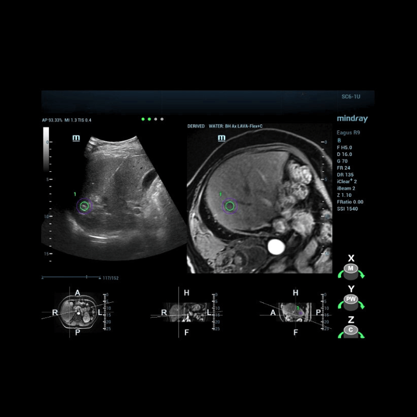 Kompatibilna s Mindray CT/MR/PET-CT/UZV iFusionom!