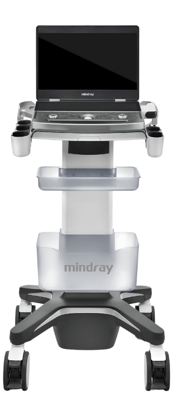 Mindray MX7 ultrazvuk medicinska oprema uzv ultrazvučni uređaj ultrazvučni aparat medicinski ultrazvuk prodaja zagreb hrvatska cijena iskustva medexpert