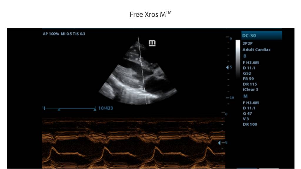 Gain precise anatomical observation by freely placing sample lines at any angle.