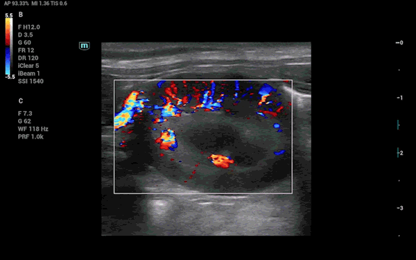 Canine Kidney Vessel