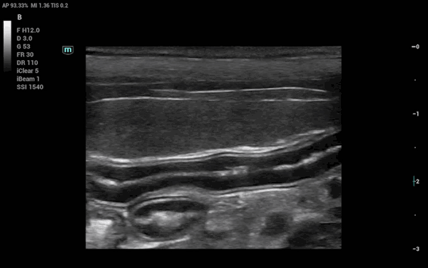 Canine Spleen and Interstine