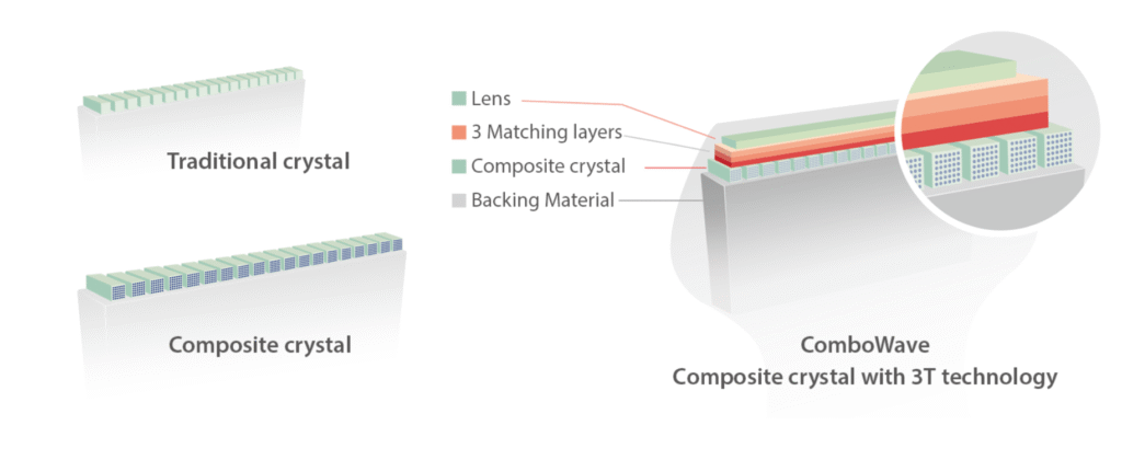 zst tehnologija platforma mindray zst technology zone sonography technology