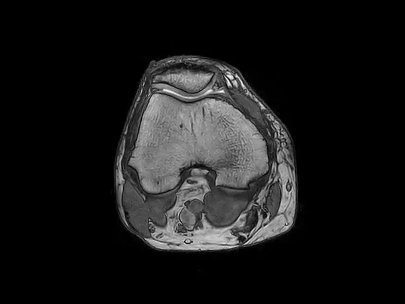 O-scan - Knee 3D SHARC Axial