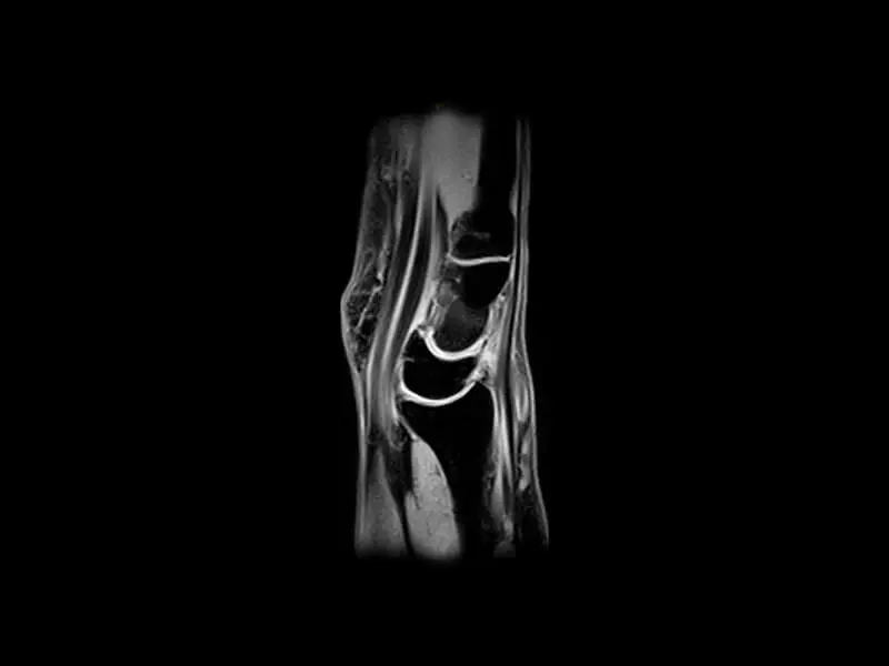 O-scan - Wrist XBONE Sagittal