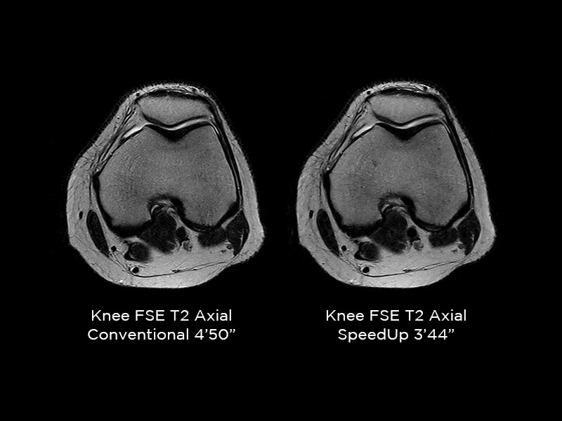 G-scan - C-spine Axial 3DHyce