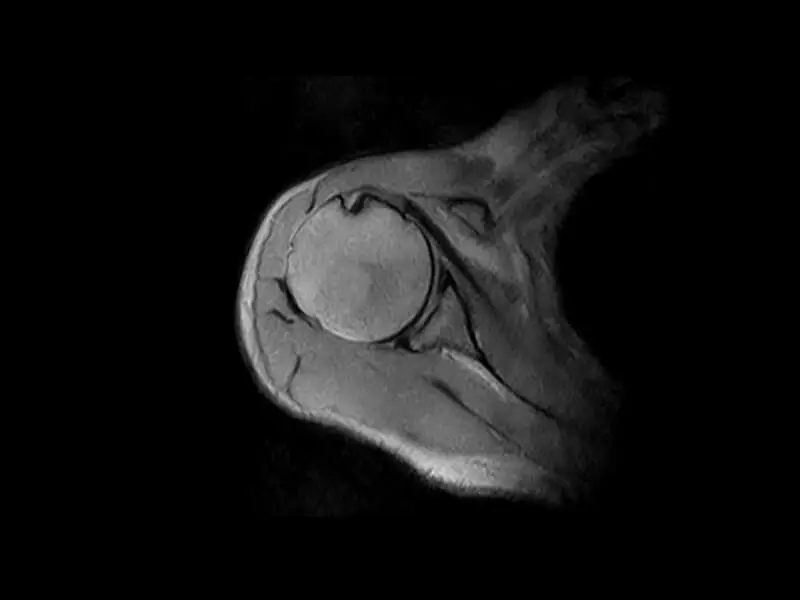 G-scan - Shoulder GE T2 Axial