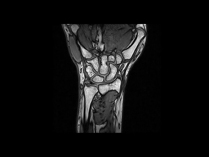 G-scan - Wrist 3D SST1 Sagittal