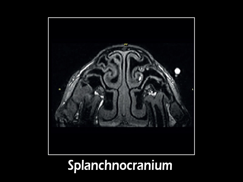 Esaote G-scan equine – GE 3D T1 Axial MPR Splanchnocranium
