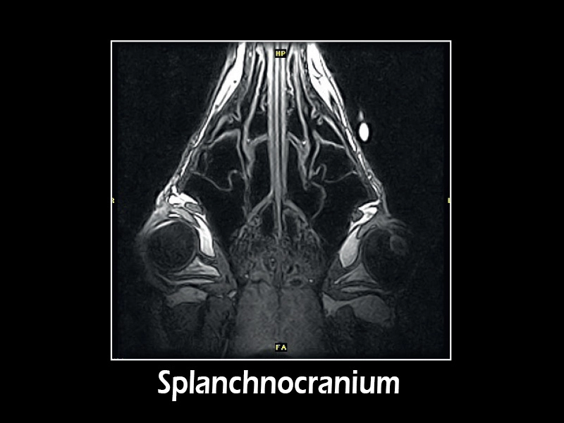 Esaote G-scan equine – GE 3D T1 Dorsal Splanchnocranium
