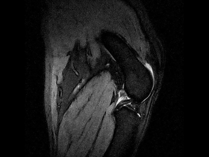 Magnifico Vet – GE STIR Sagittal Stifle