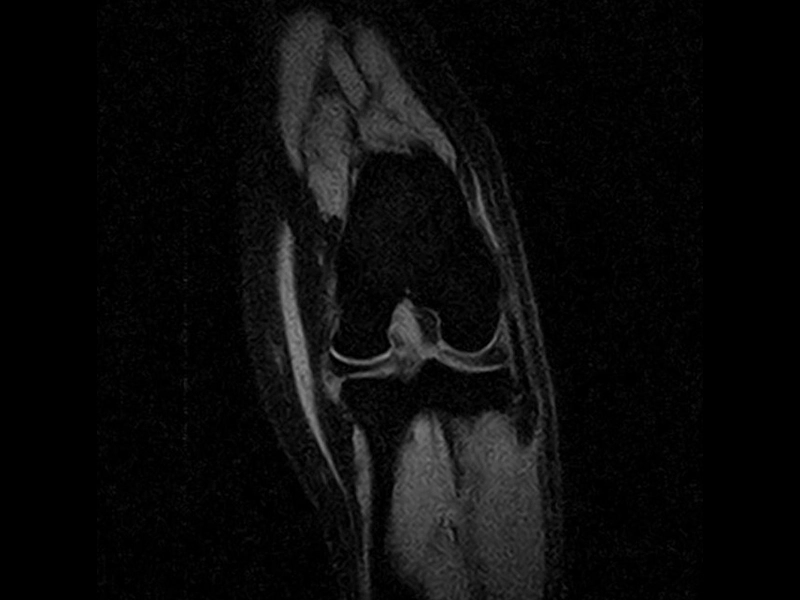 Magnifico Vet – SPED Dorsal Stifle