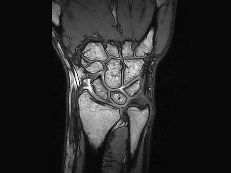 Magnifico™Open - Wrist 3D SHARC Coronal