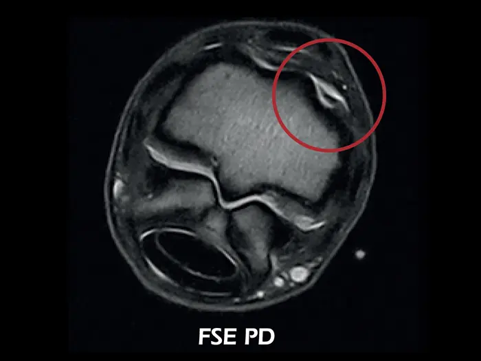 Esaote O-scan VET – FSE PD Axial Fetlock Arthropathy