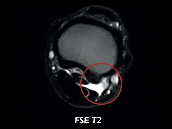 Esaote O-scan VET – FSE T2 Axial Fetlock Arthropathy