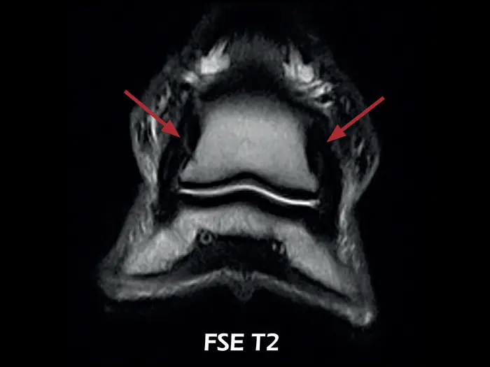 Esaote O-scan VET – FSE T2 Dorsal Lesion of the collateral ligaments of the coffin joint