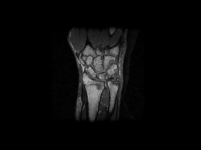 S-scan - 3D SHARC Coronal Wrist