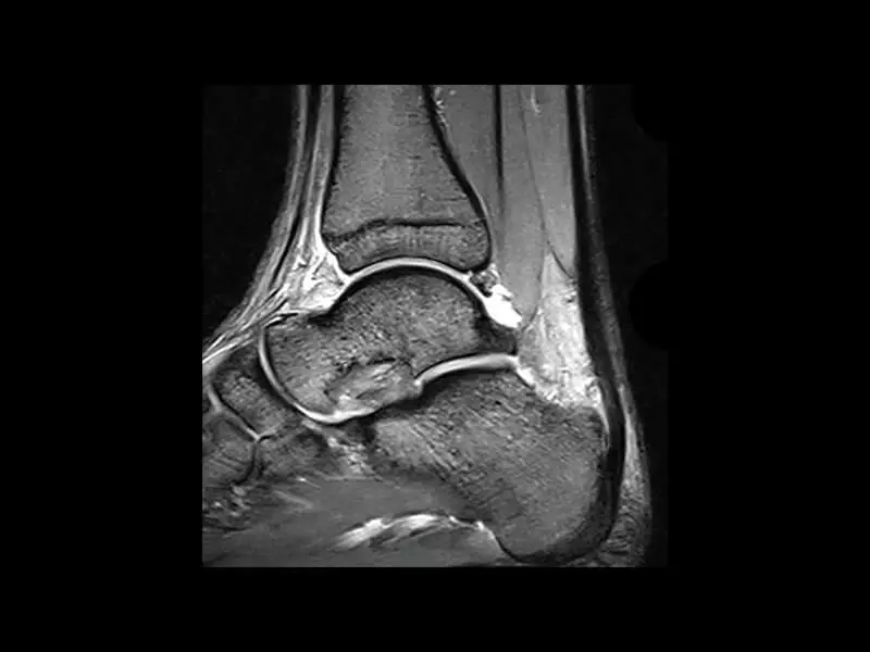 S-scan - Ankle eXP 120 resolution 0.56x0.78