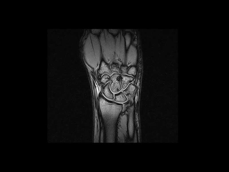 S-scan - GE T1 Wrist