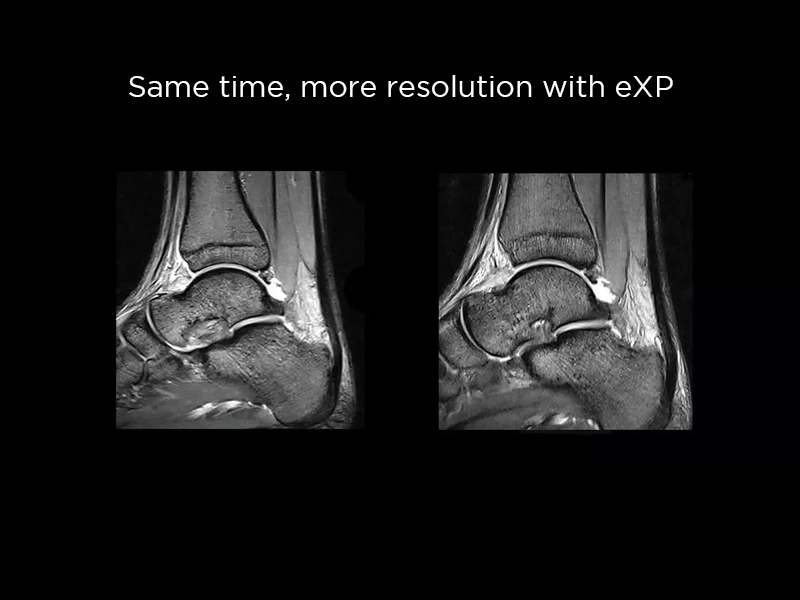 S-scan - eXP Ankle