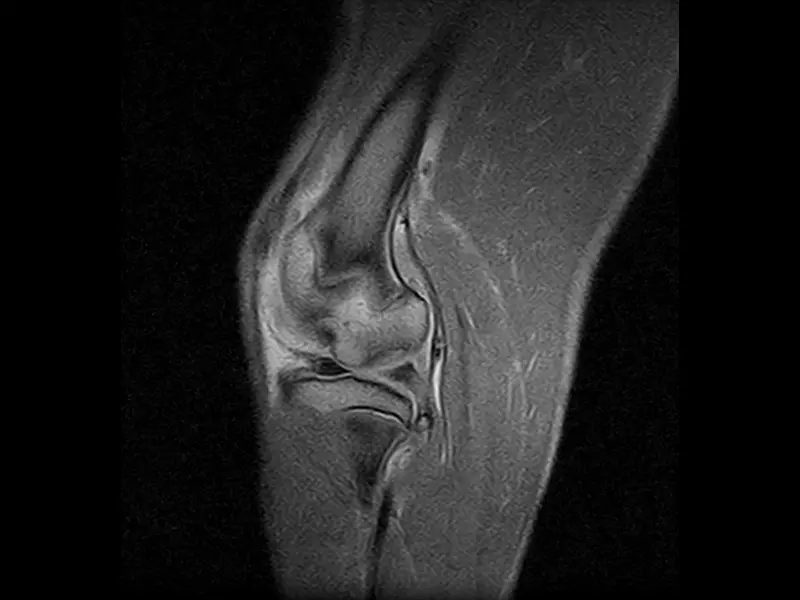 Esaote Vet-MR Grande ELITE – Stifle Sagittal FSE PD