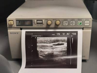 Sony UP897MD termalni medicinski printer za ultrazvuk rabljeni korišteni polovni prodaja zagreb medexpert